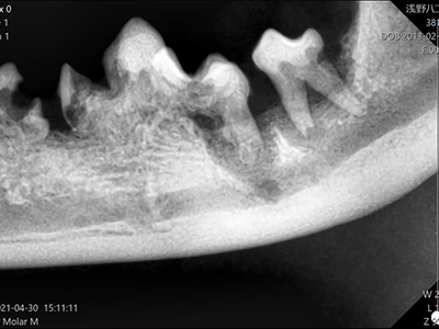 X線を撮ってみると、歯根は著しく変質し骨との境目が分からなくなっています。