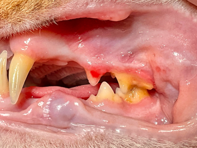 歯を覆い隠すように歯肉が伸びてくることがあります。