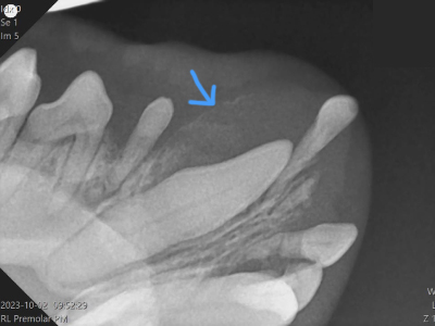 下側が右下顎で大きな犬歯が存在しています。歯冠部外側の骨は大きく膨らみペラペラになっています。