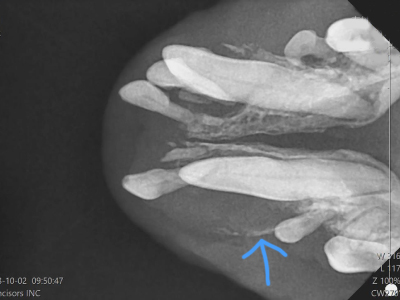 角度を変えた撮影でも歯冠部周辺に風船のように膨らんだ薄い骨が確認できます。かなり変化していますが骨折を引き起こす前に抜歯することが出来ました。