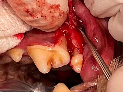 オープンフラップデブライドメント開始。歯肉を切開してみると、あるべき骨はなく根っこが露出していて歯石まみれになっています。