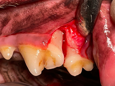 マイクロスコープを用いて根っこの表面を徹底的に清掃します。