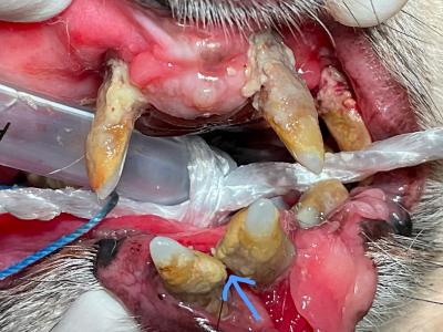 重度の歯周病により下顎先端の骨がなくなり、左右の顎が外れてしまいました。手足の骨折と違い繋げ合わせたい箇所の骨は既に失われているため、繋げ直すことが出来ません。今以上の骨の喪失を止め、顎の先端を軽量化して生活しやすくするために全抜歯となりました。